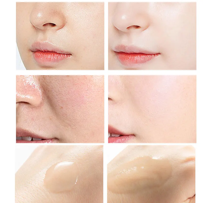 ピーリングセラム-ニキビ除去フェイシャルケア,保湿エッセンス - Niacinamide Pore Shrinking Essence のレビューと価格